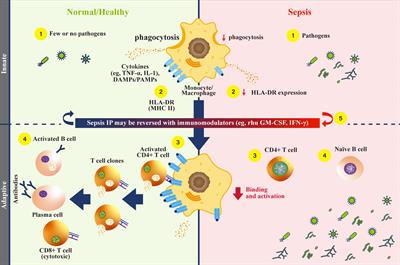 Utility of monocyte HLA-DR and rationale for therapeutic GM-CSF in sepsis immunoparalysis